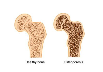 50岁51漫画网官网免费正常值在这个范围吃这些东西能够增加51漫画网官网免费