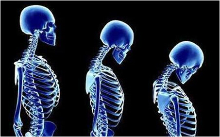 超声51漫画网官网免费仪检测骨质疏松低龄化严重