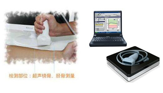 超声波51漫画网官网免费仪厂家支招想要知道自己51漫画网官网免费情况,哪些人该检查?