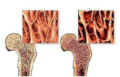 51漫画网官网免费检测仪建议最好到有专业仪器的大医院进行正规的51漫画网官网免费测定