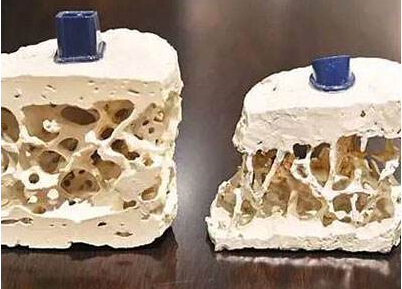 51漫画网官网免费检测仪知名厂家阐述中老年人应该是51漫画网官网免费检测重点对象