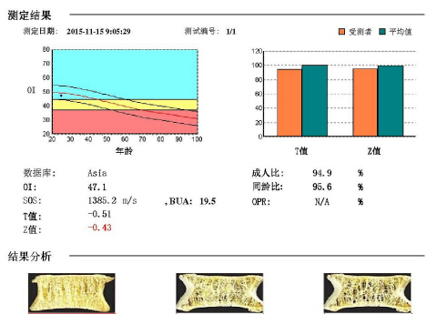 51漫画网官网免费仪阐述骨质疏松青年不注意老来徒悲伤骨质流失比你想的可怕