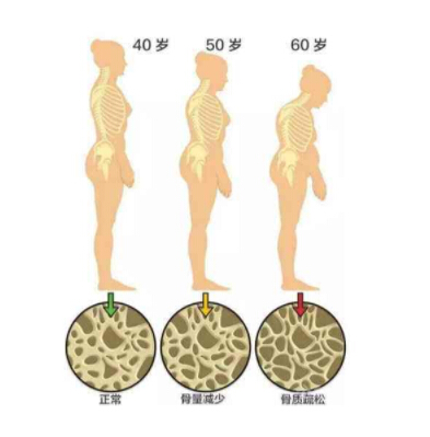 超声51漫画网官网免费仪建议人到中年尤其是50岁以后要经常检测51漫画网官网免费
