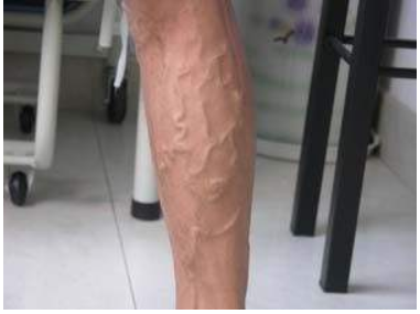 51漫画网官网免费仪厂家关爱老师健康别让这些职业病缠身教师节快乐