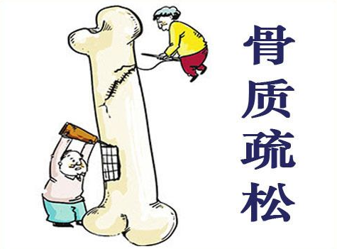 超声波51漫画网官网免费仪阐述患有骨质疏松症后都容易有哪些表现早发现早治疗