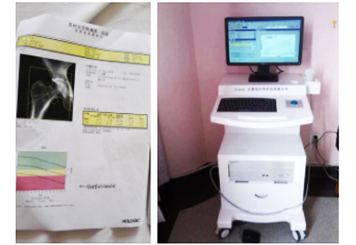 51漫画网官网免费仪康复科检验神器"C位出道"在各大医院门诊体检中心预防51漫画网官网免费T值低于－2.5