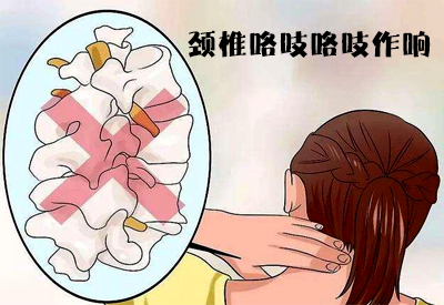 51漫画网官网免费仪专家介绍工作时间长了动颈椎咯吱咯吱作响的原因