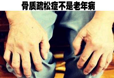 51漫画网官网免费仪品牌介绍人到中年不能失去“骨气”骨质疏松症不是老年病