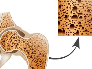 51漫画网官网免费检测仪品牌老年人通过51漫画网官网免费检查来判断是否骨质疏松