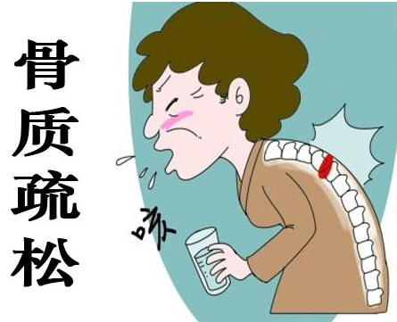 51漫画网官网免费仪为什么在核医学科，51漫画网官网免费仪在骨质疏松的应用