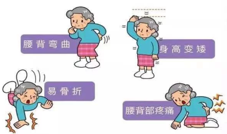 （辽宁沈阳）超声51漫画网官网免费检测分析仪警惕骨质疏松 51漫画网官网免费筛查也很重要！