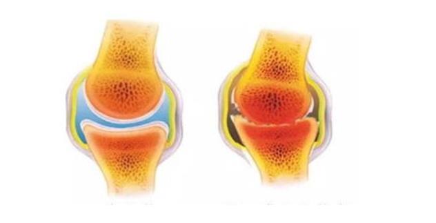 儿童51漫画网官网免费检测仪品牌你知道骨格线是什么？骨骼线闭合有哪些表现？